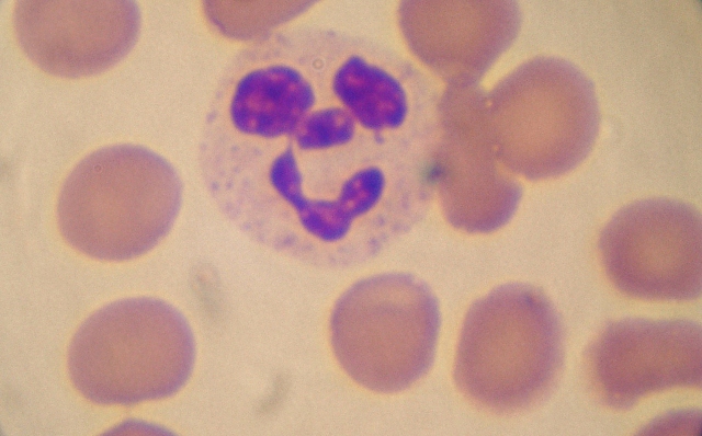 Happy White Blood Cell Hard at Work