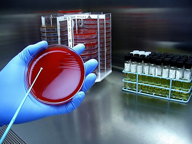 E. coli, it's what's on your plate