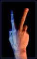 X-Rays (Accidentally Discovered in 1895)