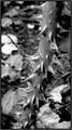 Rose Thorns