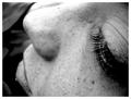 Big nose & Long lashes & Freckles
