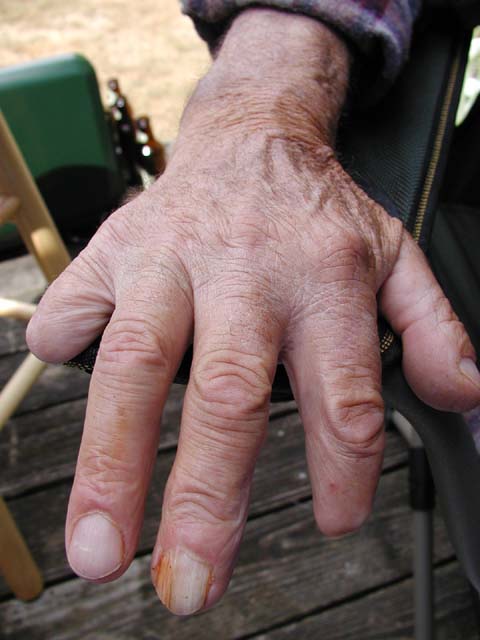A hand that's been through a lifetime