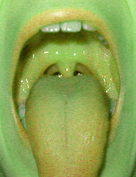 Entering the green mouth ! ! !