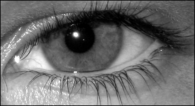 My Eye