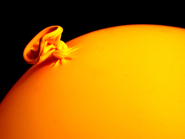 Balloon
