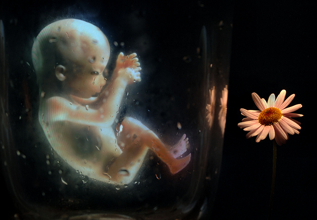 A Womb With a View
