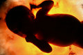 Womb
