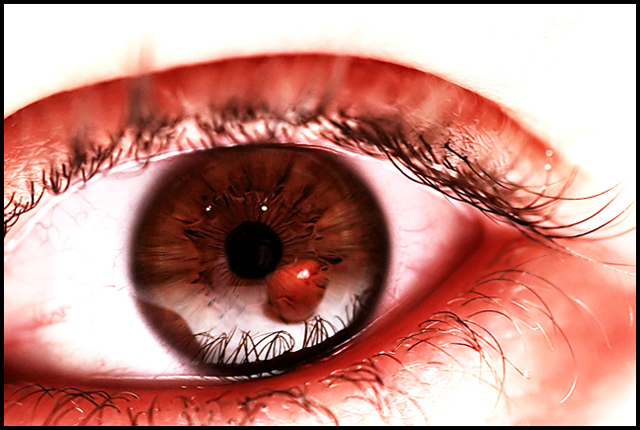 Apple of My Eye