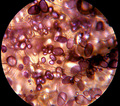 Iodine Stained Starch Granules in Potato Cells