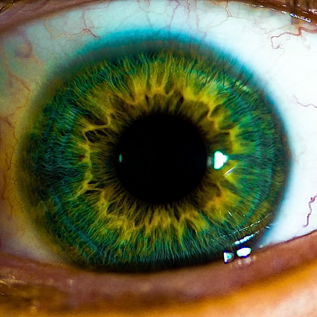 Eye Study
