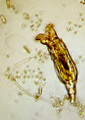 Microbiology - rotifer at 500x