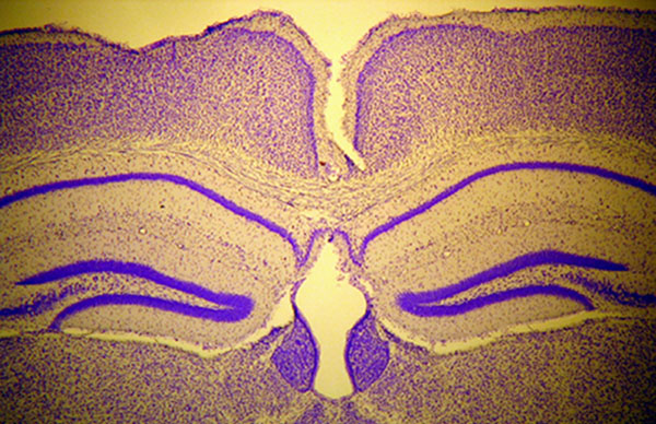 Todays lesson: A closer look into the brain of the mouse (Mus musculus .L)