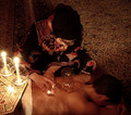 Fire Cupping