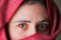 Blood eye