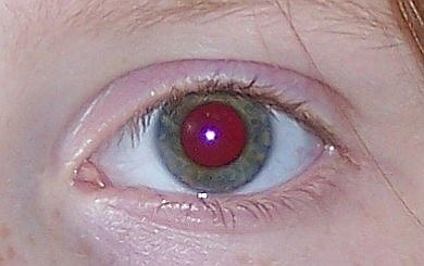 Red Eye