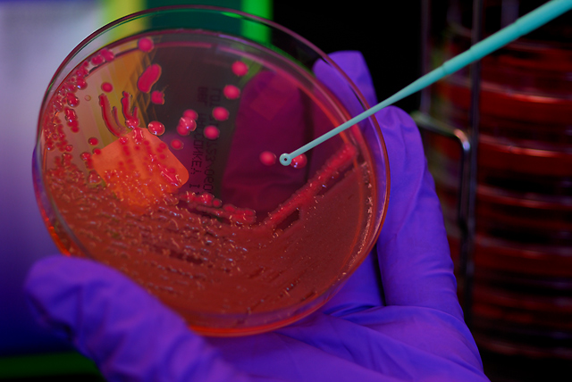 Lactose Fermenting Bacteria