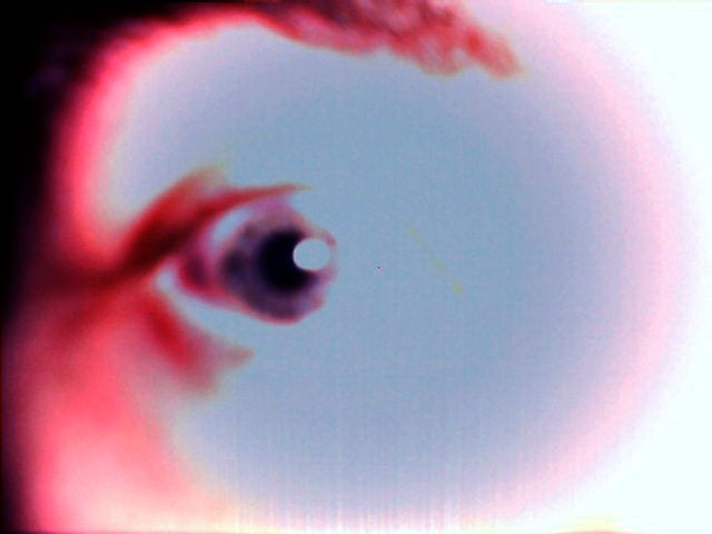 My Eye