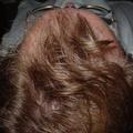 I am not going bald!!!