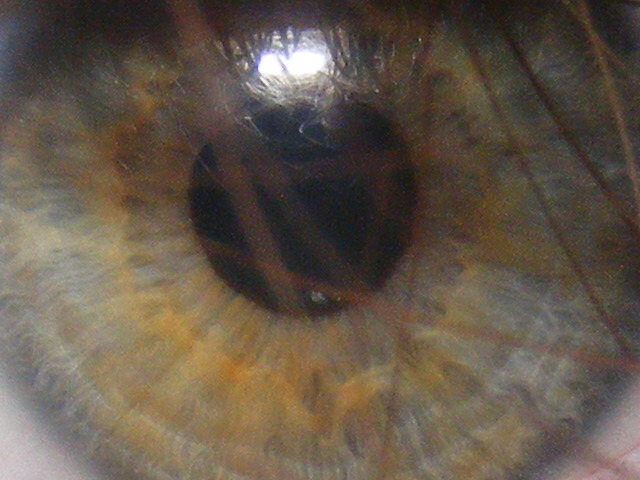 Hazel Eye