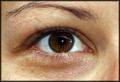 The Eye