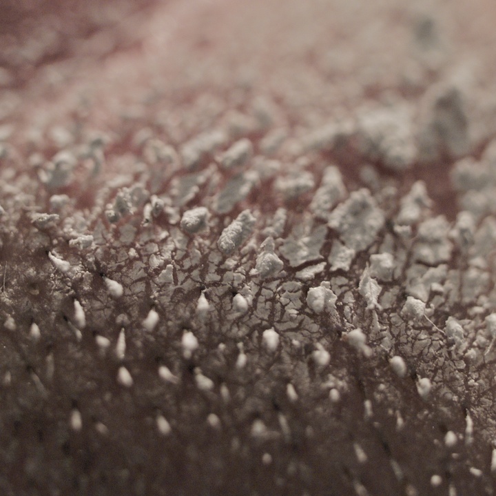 abrasion