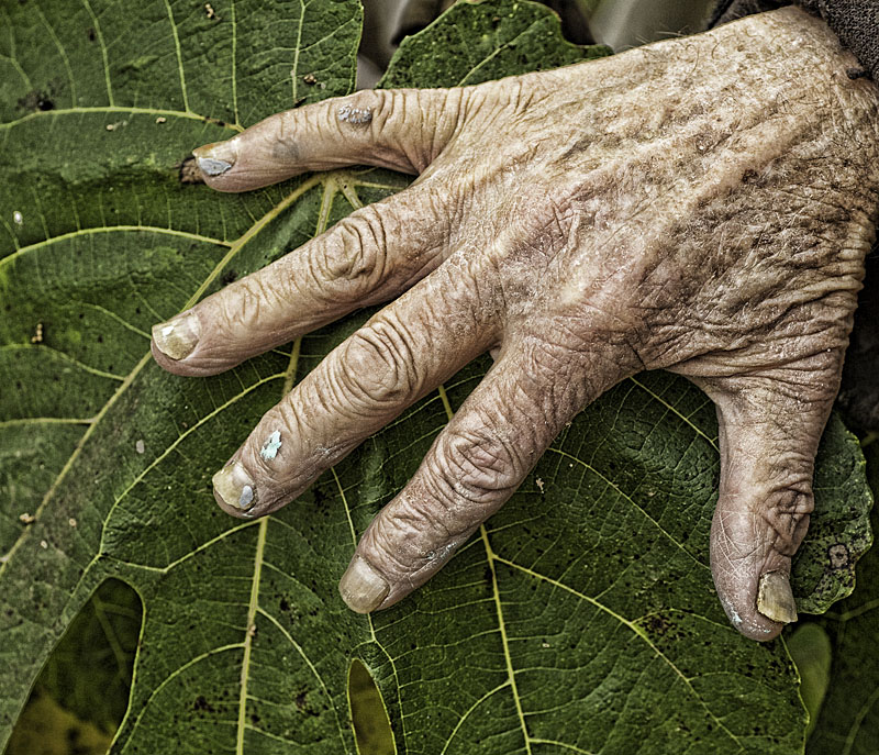 Wrinkled Surface and lots of veins