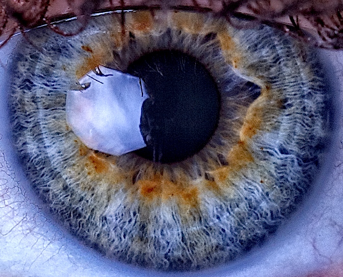 Eye of the Beholder