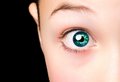 Photoeye
