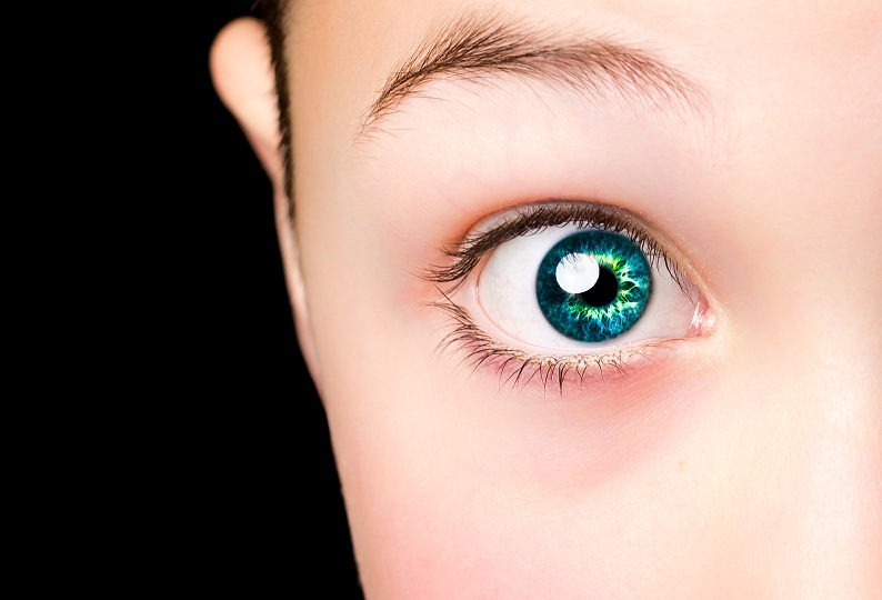 Photoeye
