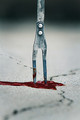 We all Bleed