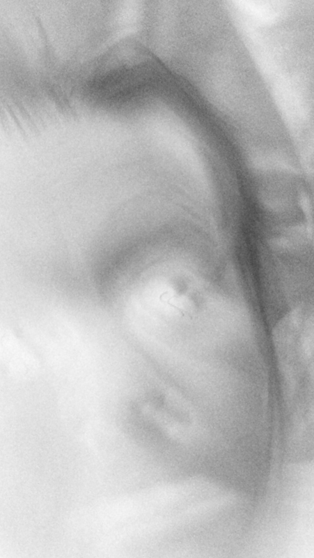 opposite pain hope