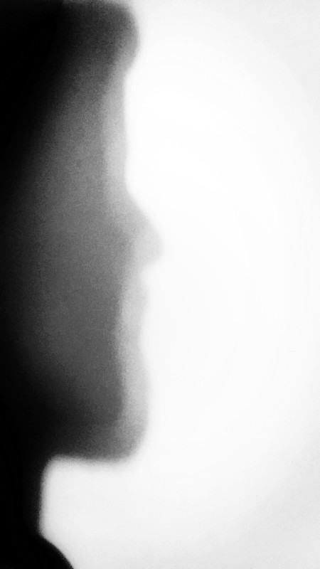 reflexive