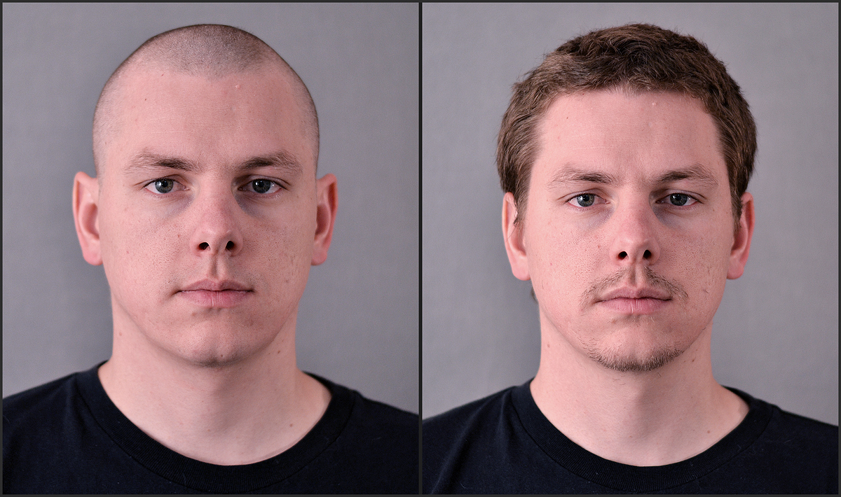 Before and after Movember