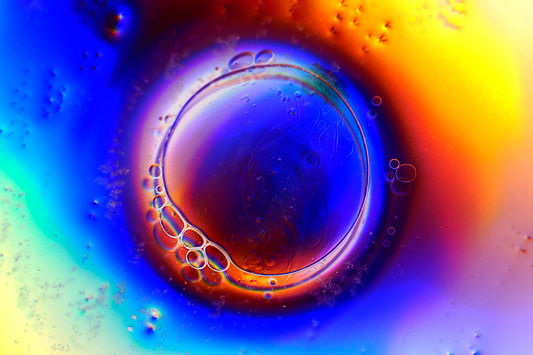 Mitosis
