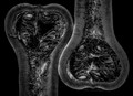 Autopsy