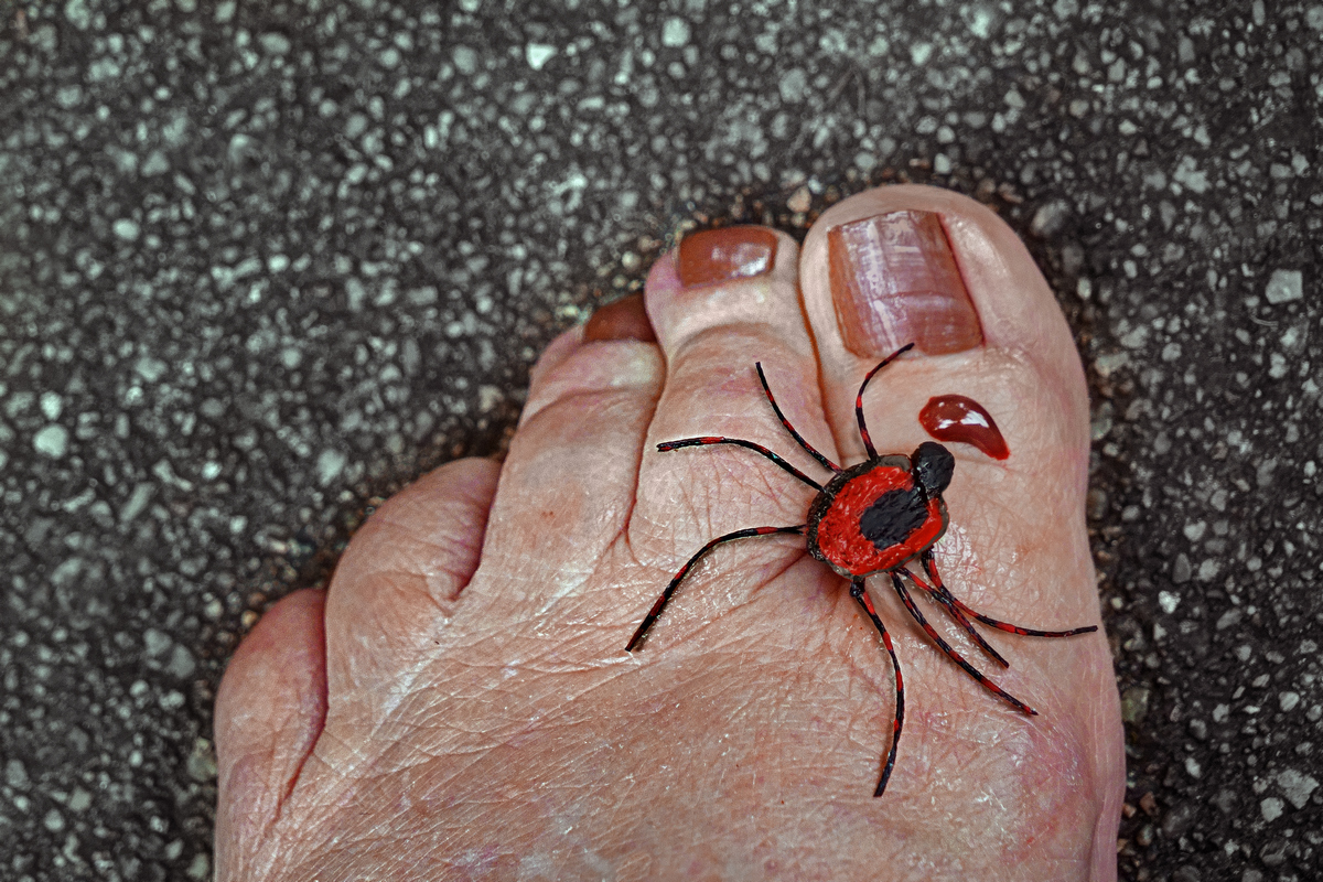 And  . . . A Tick Attack a Toe