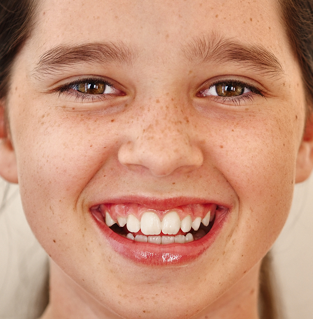 Smile and the world smiles with you.