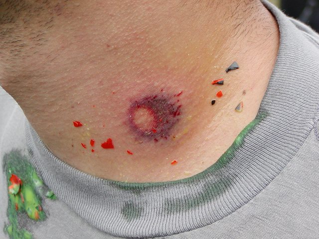 2003-09-13_noah_flesh_wound.jpg