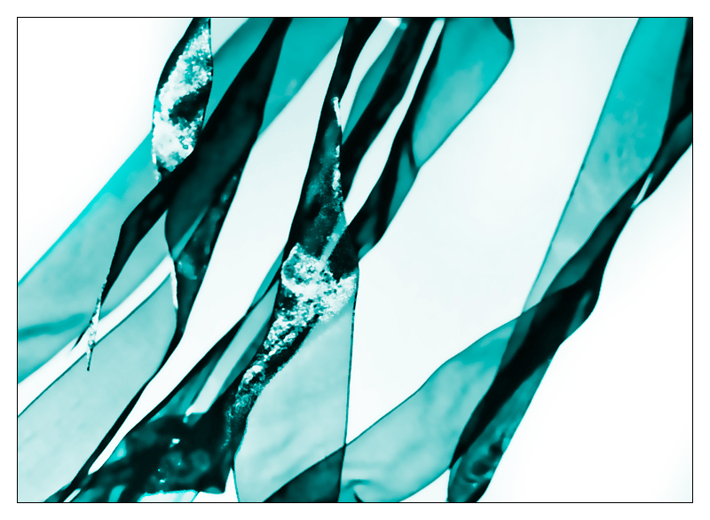 Shards