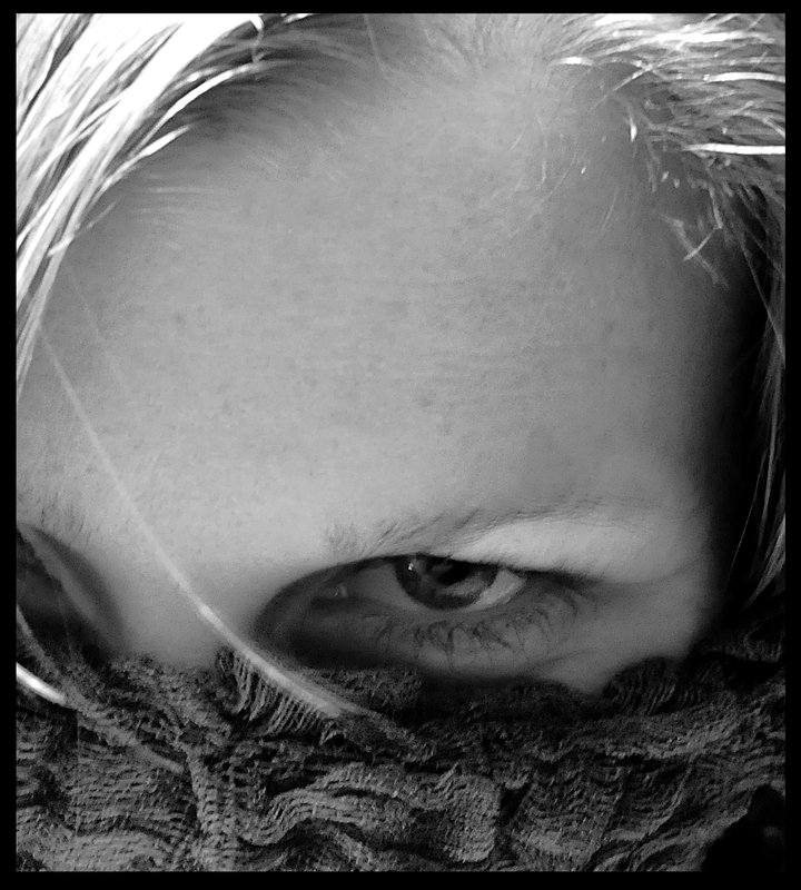 Eye