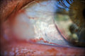 ½ of a Puzzled Eye