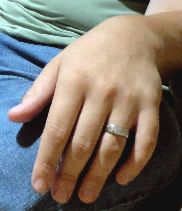 gold ring