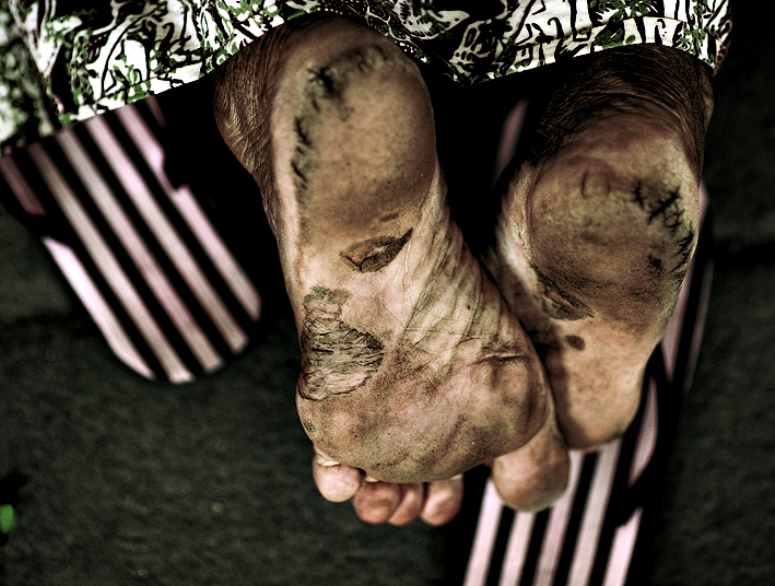 worn