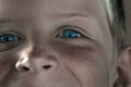 Freckles