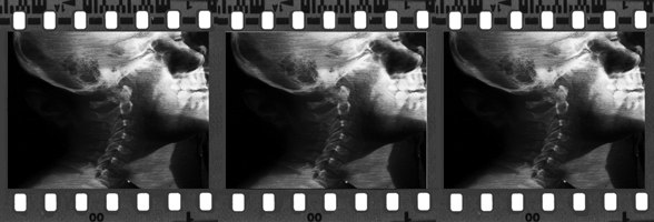xrayfilmstripsized.jpg