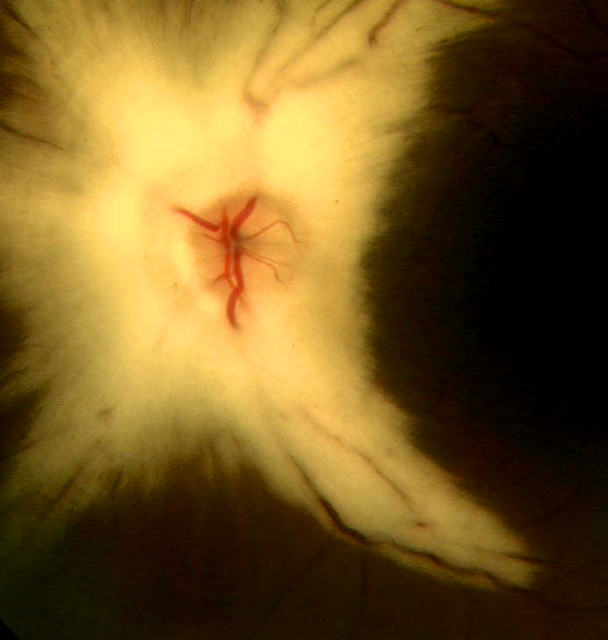 ON-MYLENIZATION.jpg