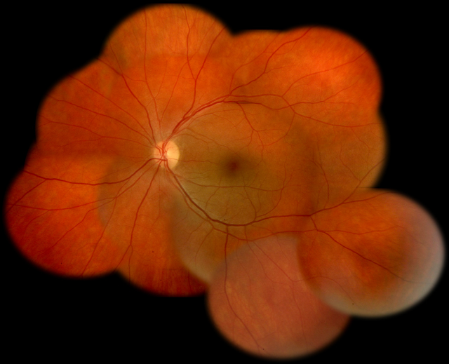 eye.jpg