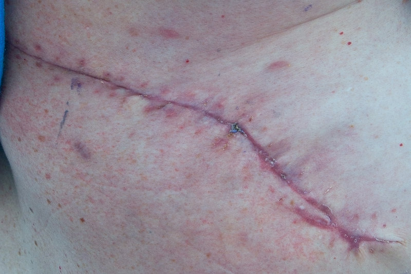 Feb-2011, 21-days-after-2nd