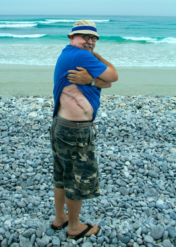Shark Bite