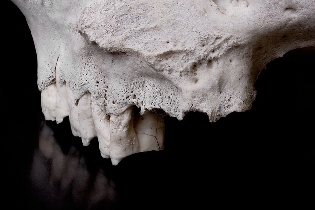 Bones